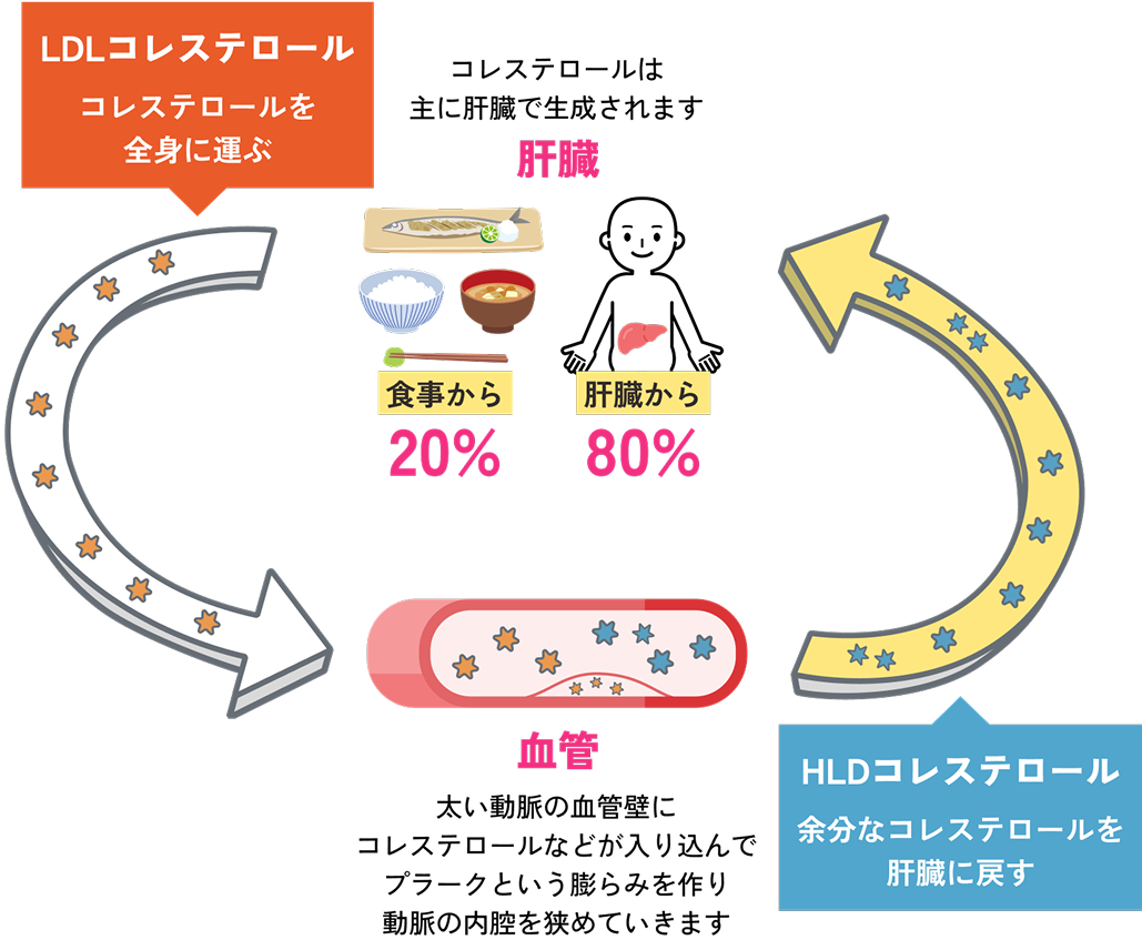 善玉と悪玉のコレステロールの関係図
